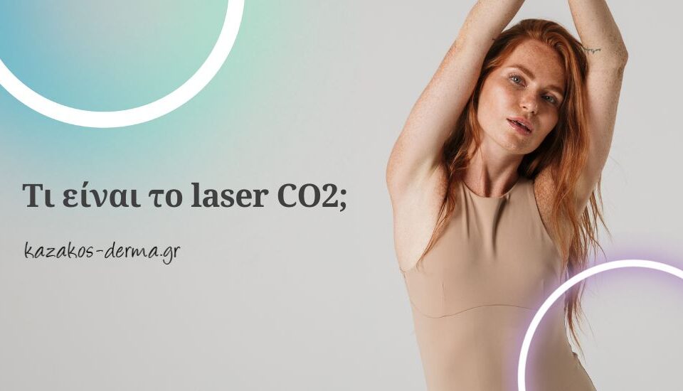 laser co2