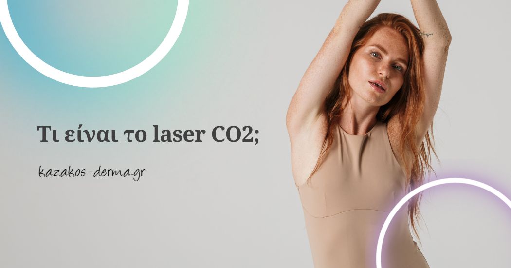 laser co2