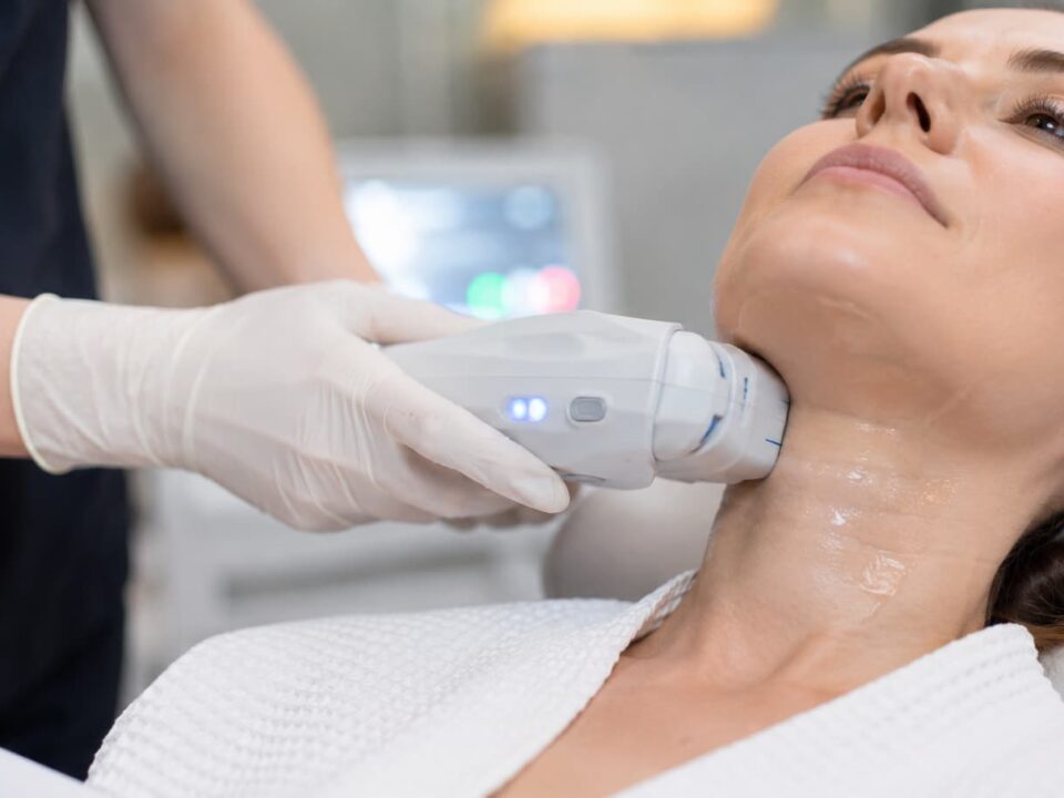 Ultherapy στον Λαιμό